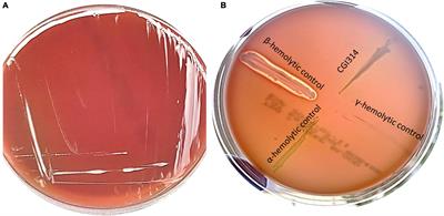 In vitro safety and functional characterization of the novel Bacillus coagulans strain CGI314
